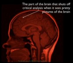 Der unkritische Teil des Gehirns, der Gehirnbilder toll findet (Foto: quinnums, flickr; Lizenz: Creative Commons)